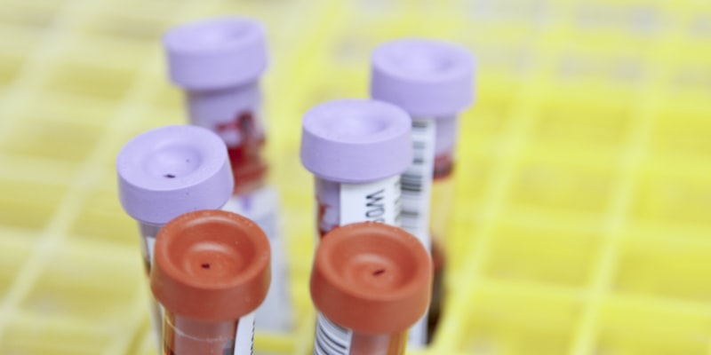 Meilleure teleassistance pour senior en 2026